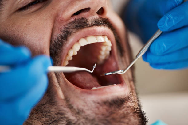 TMJ/TMD Treatment in Tracy City, TN
